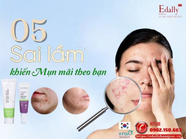 5 sai lầm chết người khiến bạn mãi không thoát khỏi mụn