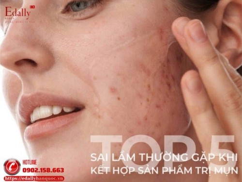 Top 5 Sai Lầm Khi Kết Hợp Sản Phẩm Trị Mụn Khiến Mụn Ngày Càng Tệ Hơn