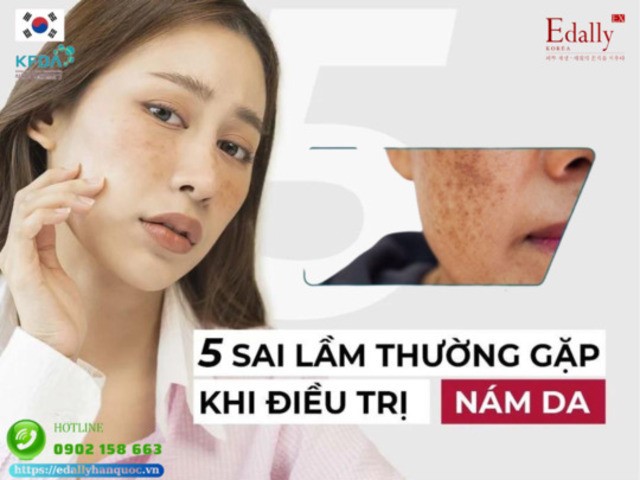 5 sai lầm khiến điều trị nám da mãi không khỏi