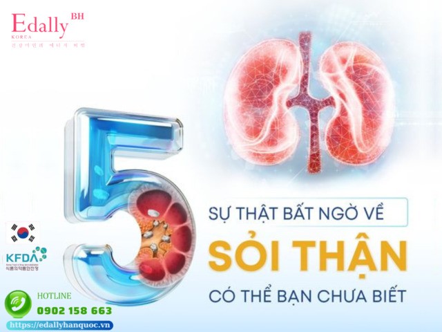 5 sự thật bất ngờ về sỏi thận có thể bạn chưa biết