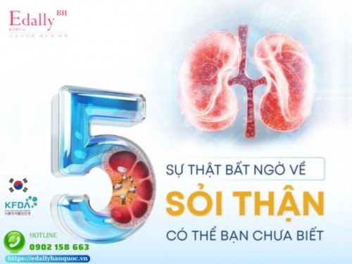 5 Sự Thật Bất Ngờ Về Sỏi Thận Có Thể Bạn Chưa Biết