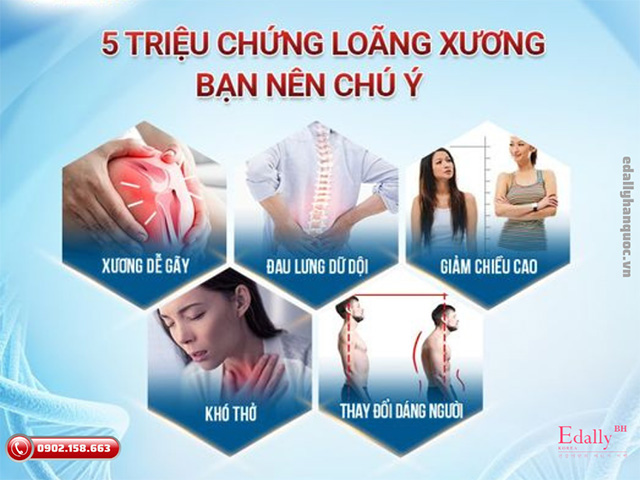 5 triệu chứng loãng xương cần chú ý để phòng ngừa sớm