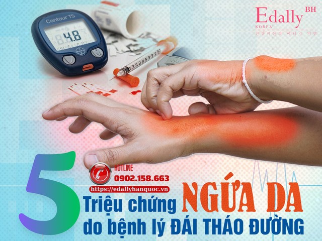 5 triệu chứng ngứa da do bệnh tiểu đường gây ra