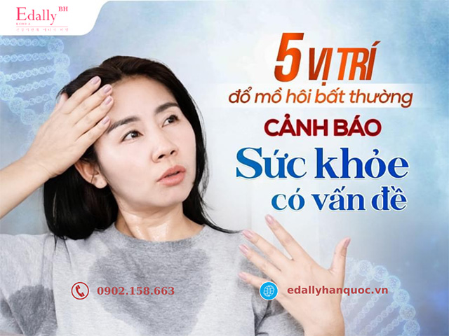 5 vị trí đổ mồ hôi bất thường cảnh báo sức khỏe của bạn đang có vấn đề