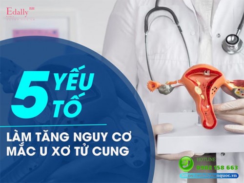 5 Yếu Tố Làm Tăng Nguy Cơ U Xơ Tử Cung