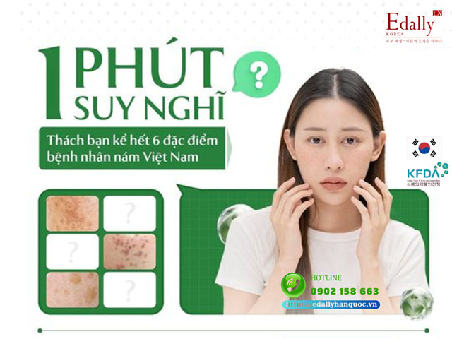 6 đặc điểm của bệnh nhân nám da tại Việt Nam