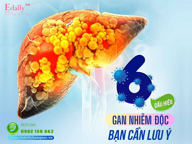 6 dấu hiệu cảnh báo gan bị nhiễm độc tố