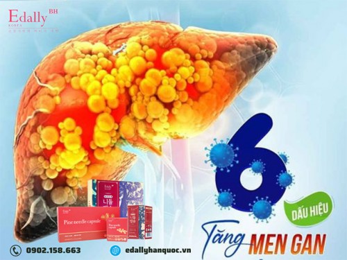 Các Dấu Hiệu Tăng Men Gan Cần Lưu Ý 