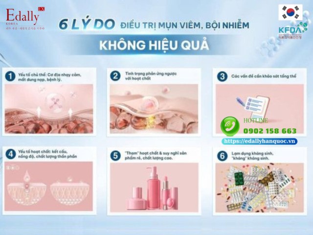 6 Lý do điều trị mụn viêm, bội nhiễm không hiệu quả