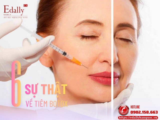 6 sự thật cần biết trước khi sử dụng Botox