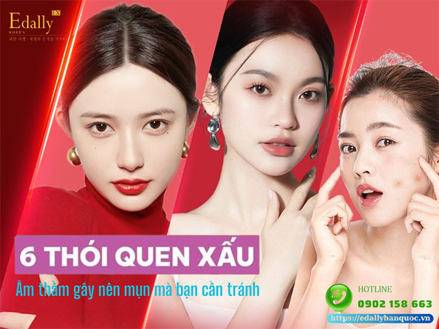 6 Thói Quen Xấu Âm Thầm Gây Mụn Mà Bạn Cần Tránh