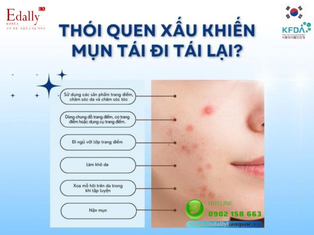 6 thói quen xấu khiến mụn tái đi tái lại