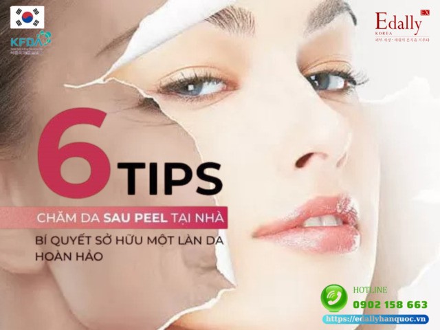 6 Tips Chăm Da Sau Peel Da Tại Nhà - Bí Quyết Sở Hữu Làn Da Đẹp Hoàn Hảo