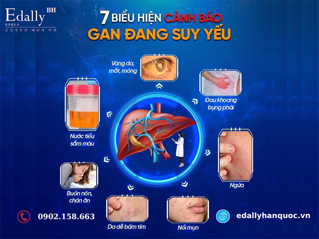 7 Biểu Hiện Cảnh Báo Suy Giảm Chức Năng Gan