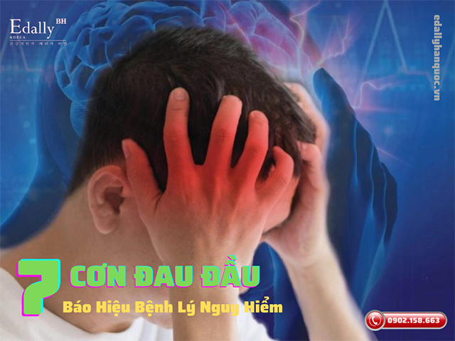 7 cơn đau đầu báo hiệu bệnh nguy hiểm cần hết sức lưu ý