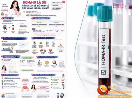 HOMA-IR Là Gì Và Có Nên Làm Để Biết Mình Có Bị Đề Kháng Insulin Không?
