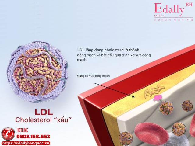 LDL-Cholesterol là Cholesterol xấu