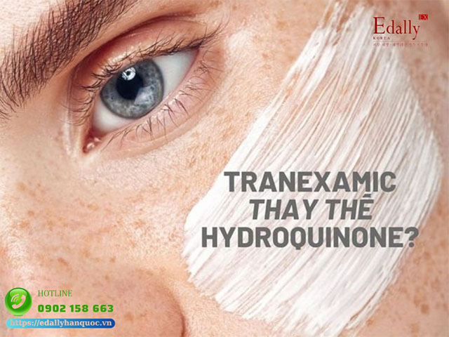 Tranexamic acid thiếu gì để có thể thay thế Hydroquinonetrong điều trị tăng sắc tố da?