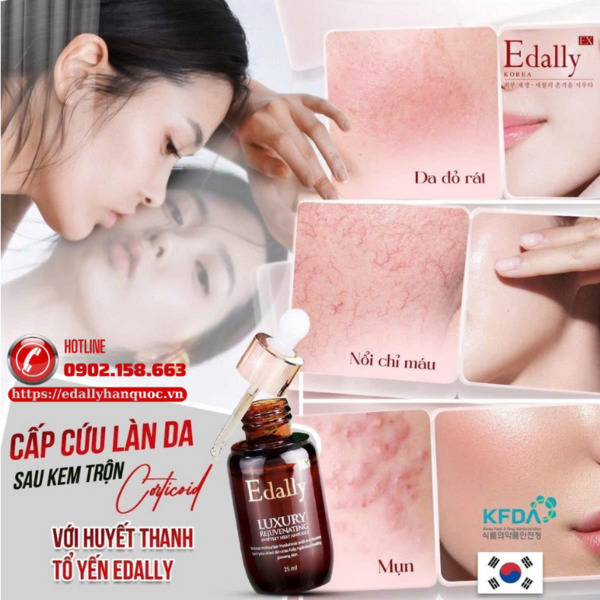Ampoule Huyết thanh tổ yến Edally EX – Cấp cứu làn da sau kem trộn