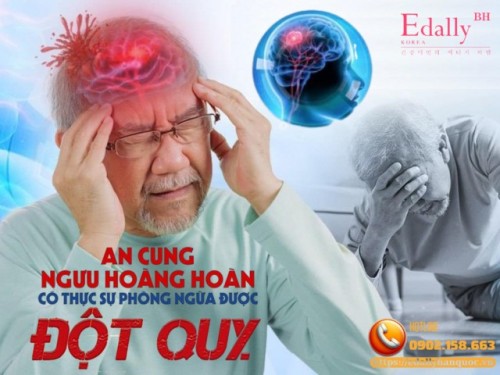 Dùng An Cung Ngưu Hoàng Hoàn Có Thực Sự Giúp Phòng Ngừa Đột Quỵ Không?