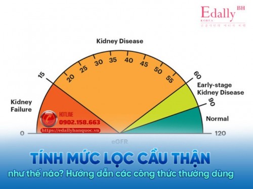 Áp Dụng Tính Mức Lọc Cầu Thận Bằng Công Thức Nào Là Tối Ưu Trong Thực Hành Lâm Sàng?