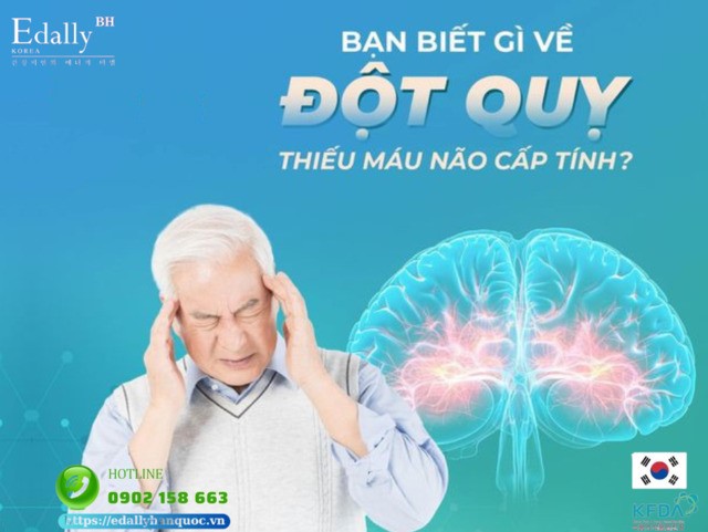 Bạn biết gì về đột quỵ thiếu máu não cấp tính?