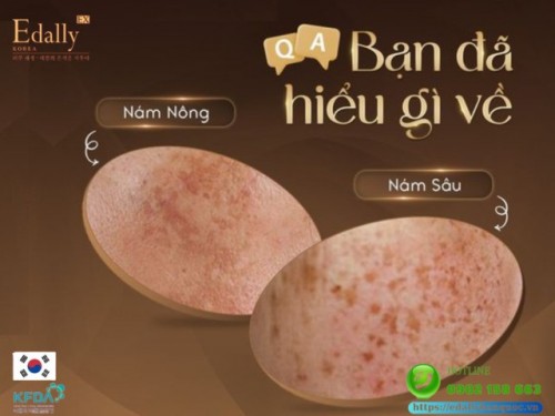 Bạn Đã Hiểu Gì Về Nám Nông Và Nám Sâu? 