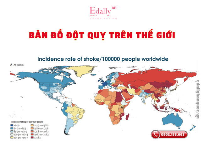 Bản đồ thể hiện đột quỵ trên Thế giới và Việt Nam nằm trong nhóm màu đỏ đậm là nhóm có nguy cơ cao nhất