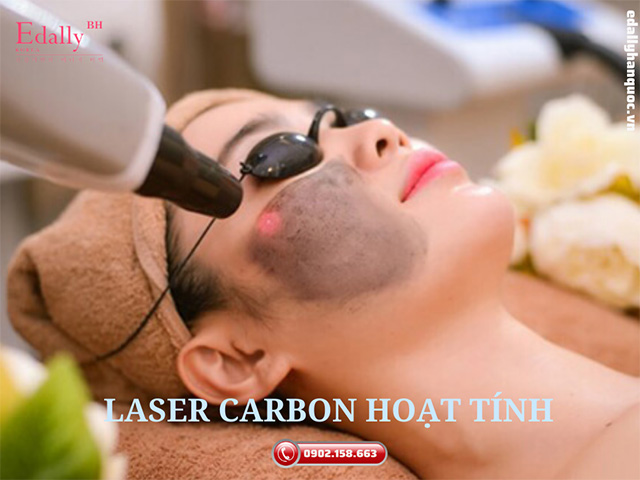 Phương pháp làm đẹp bằng bắn laser carbon hoạt tính trên da