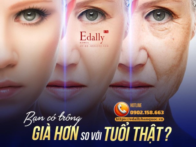 Bạn có trông già hơn so với tuổi thật của mình không?