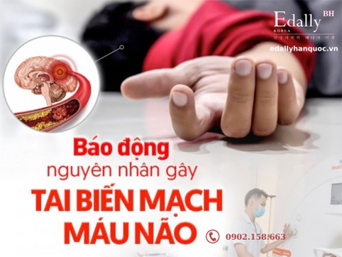 Cảnh Báo 3 Nguyên Nhân Dẫn Đến Tai Biến Mạch Máu Não