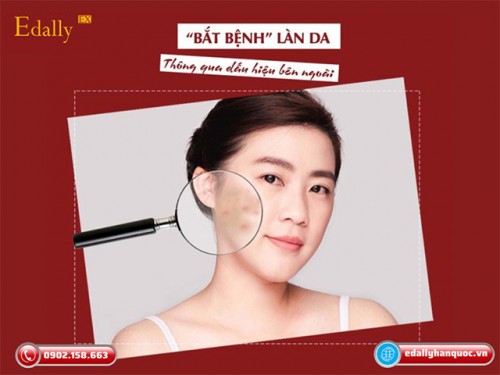 Bắt Bệnh Làn Da Thông Qua Các Dấu Hiệu Bên Ngoài