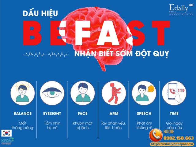 Dấu hiệu BE FAST nhận biết sớm cơn đột quỵ xảy ra