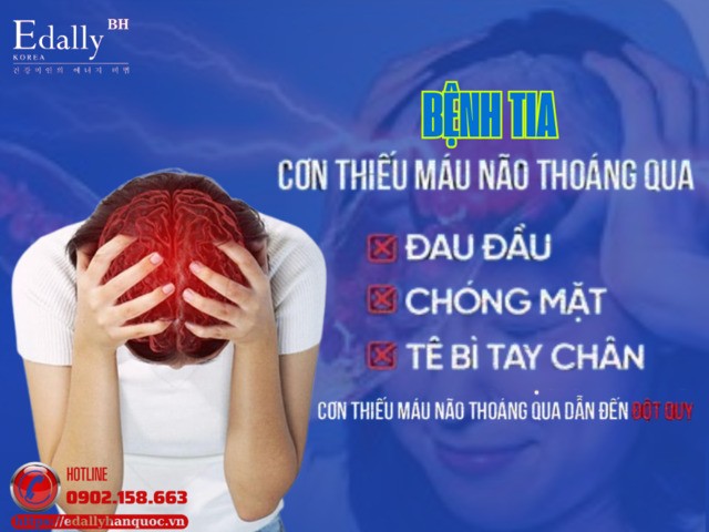 Bệnh TIA - Cơn Thiếu Máu Não Thoáng Qua