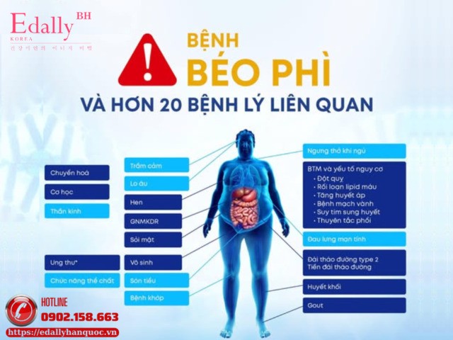 Cảnh báo: Bệnh lý béo phì và hơn 20 bệnh lý nguy hiểm liên quan