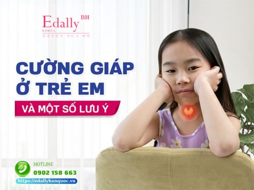 Bệnh Cường Giáp Ở Trẻ Em Và Một Số Lưu Ý