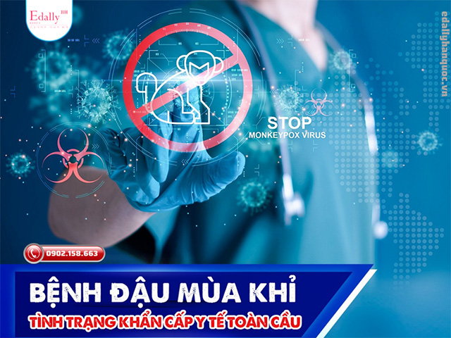 Bệnh đậu mùa khỉ được WHO công bố là tình trạng y tế khẩn cấp toàn cầu