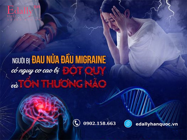 Người mắc bệnh đau nửa đầu kéo dài có nguy cơ cao dẫn đến đột quỵ và tổn thương não bộ