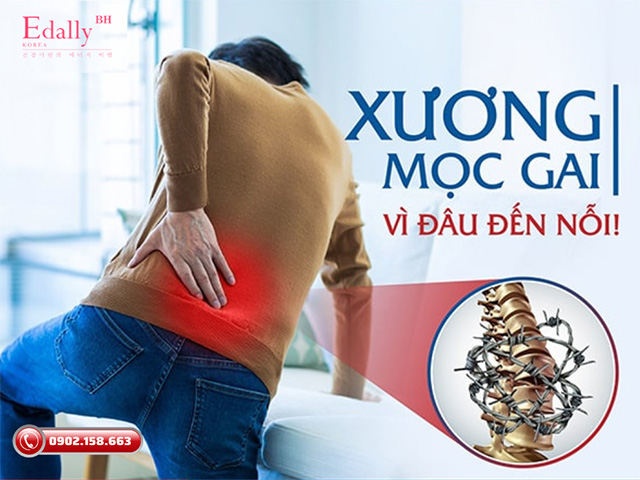 Bệnh gai cột sống và những điều cần biết để phòng tránh và điều trị kịp thời