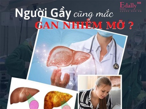 Gan Nhiễm Mỡ - Người Gầy Cũng Mắc Như Thường