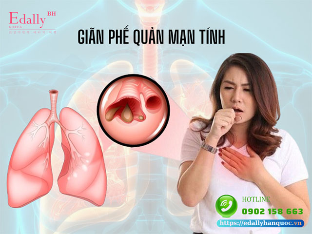 Bệnh Giãn Phế Quản Mạn Tính - Nguyên Nhân Và Cách Điều Trị