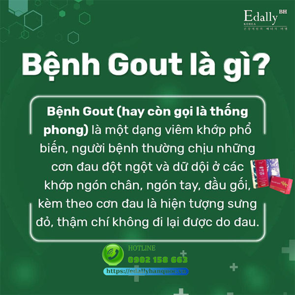 Bệnh Gout là bệnh gì?