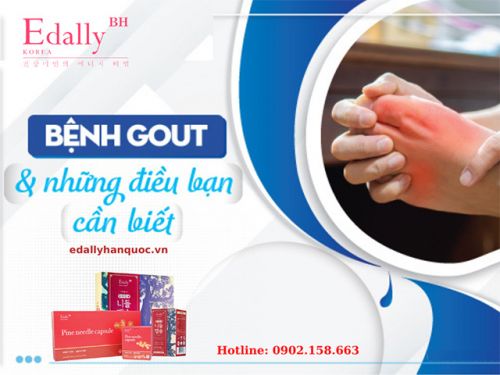 Bệnh Gút (Gout) Là Gì? Nguyên Nhân Và Cách Điều Trị?