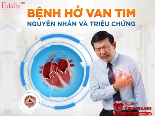 Bệnh Hở Van Tim - Nguyên Nhân Và Triệu Chứng