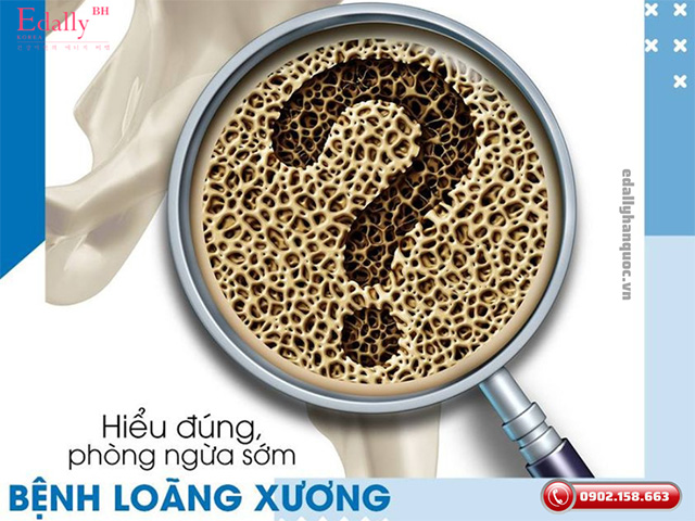 Thế nào là Bệnh loãng xương - Hiểu đúng để phòng ngừa sớm