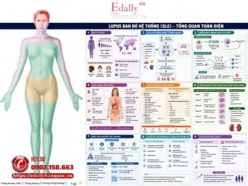 Bệnh Lupus Ban Đỏ Hệ Thống (Systemic Lupus Erythematosus - SLE) - Phần 2
