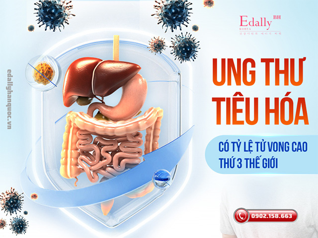 Bệnh lý ung thư đường tiêu hoá có tỷ lệ tử vong cao thứ 3 Thế giới