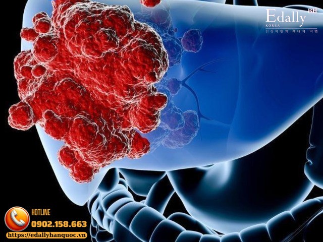 Bệnh mạn tính là gì và vì sao nhiều bệnh diễn biến mạn tính âm thầm mà cơ thể không biết?