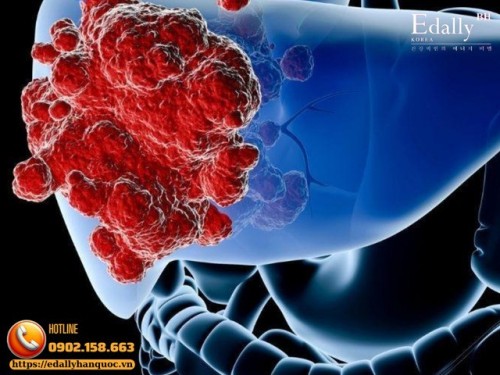 Bệnh Mạn Tính Là Gì & Vì Sao Nhiều Bệnh Diễn Biến Mạn Tính Âm Thầm Mà Cơ Thể Không Biết?