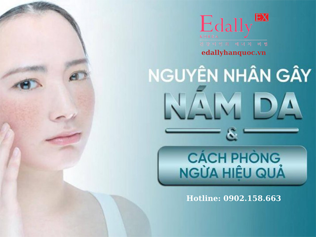 Bệnh nám da mặt nguyên nhân và cách điều trị